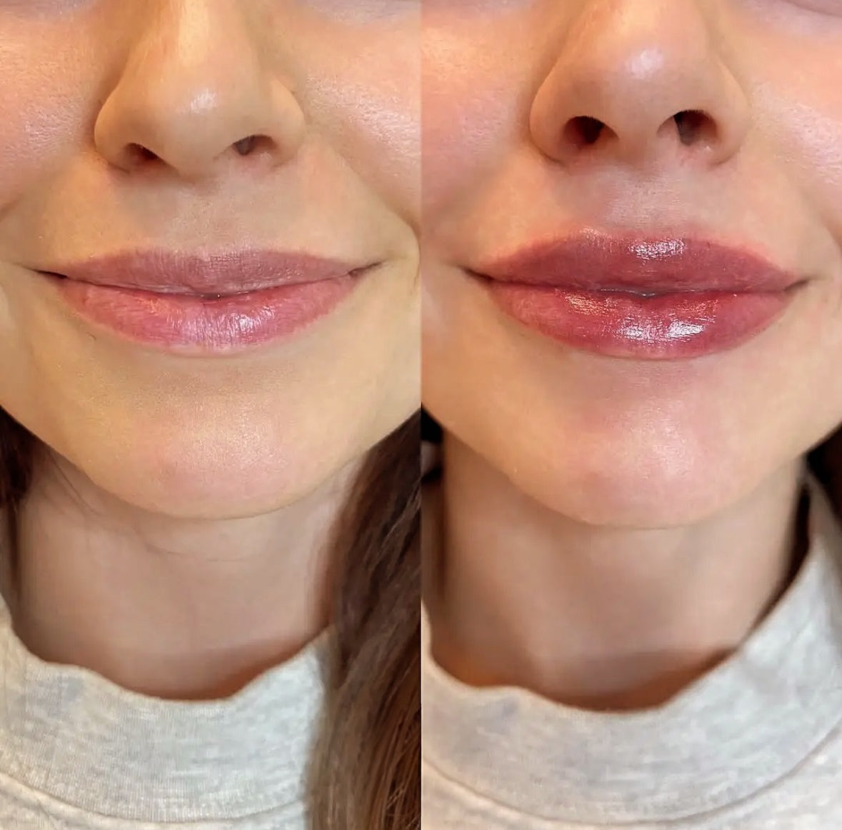 Collagen Lip Plumping Kit