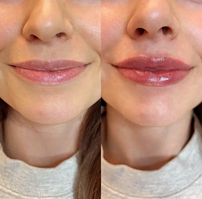 Collagen Lip Plumping Kit